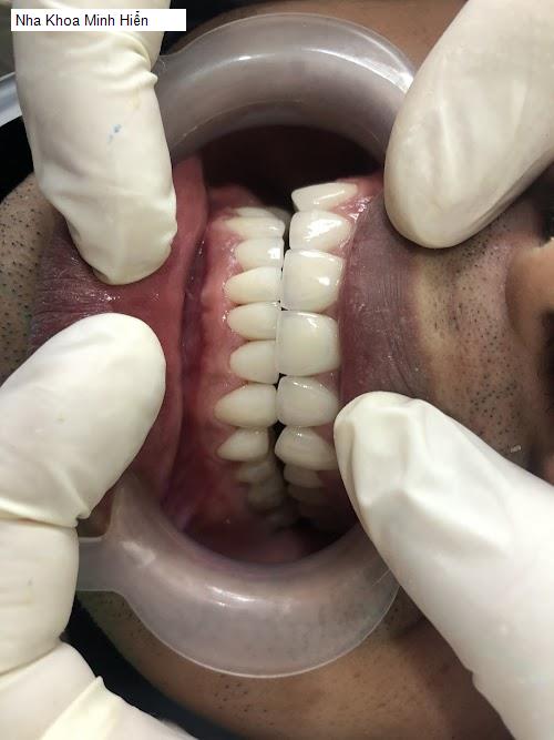 Hình ảnh Nha Khoa Minh Hiển